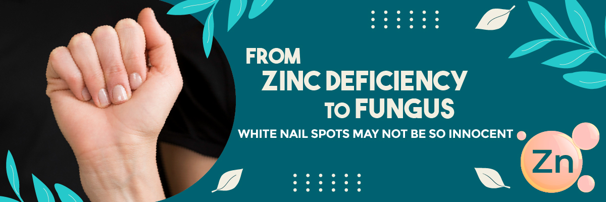 Close-up of fingernails showing white spots with text “From Zinc Deficiency to Fungus – White Nail Spots May Not Be So Innocent