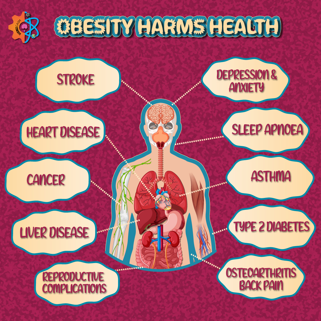 Medical illustration showing how obesity affects multiple organs and increases the risk of conditions such as heart disease, diabetes, stroke, sleep apnea, and joint pain.