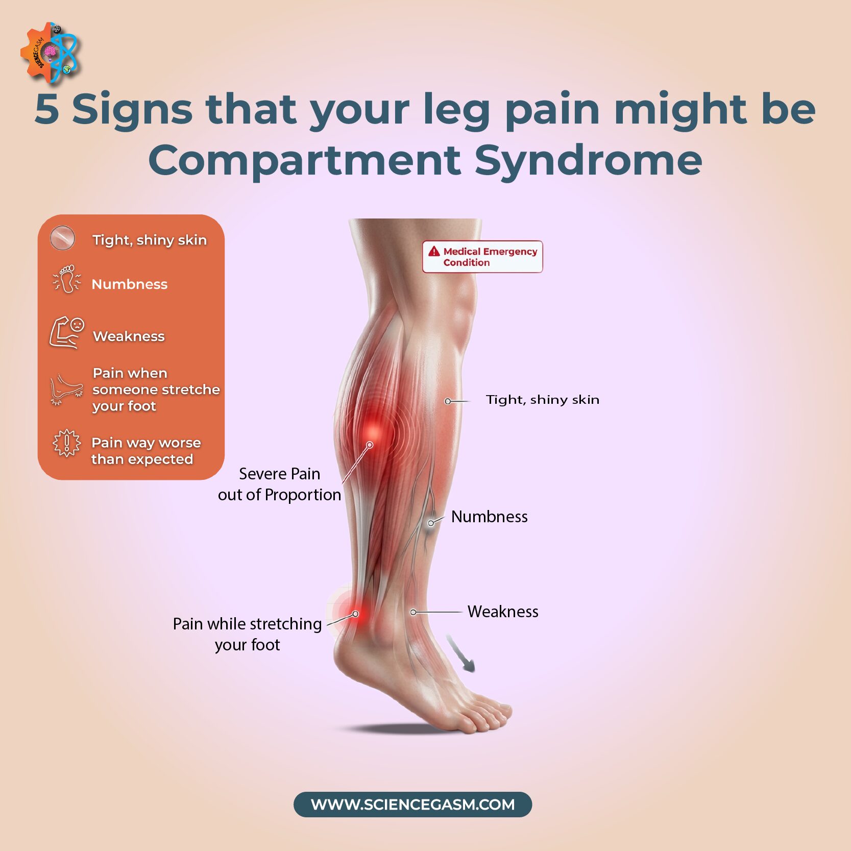 5 warning signs of compartment syndrome including severe leg pain numbness weakness shiny skin and pain during foot stretching