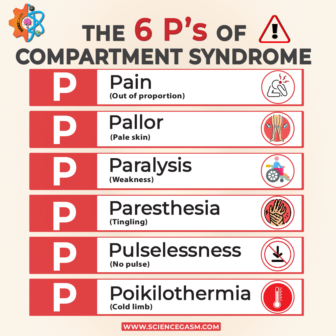 The 6 P’s are key clinical signs used to diagnose compartment syndrome.