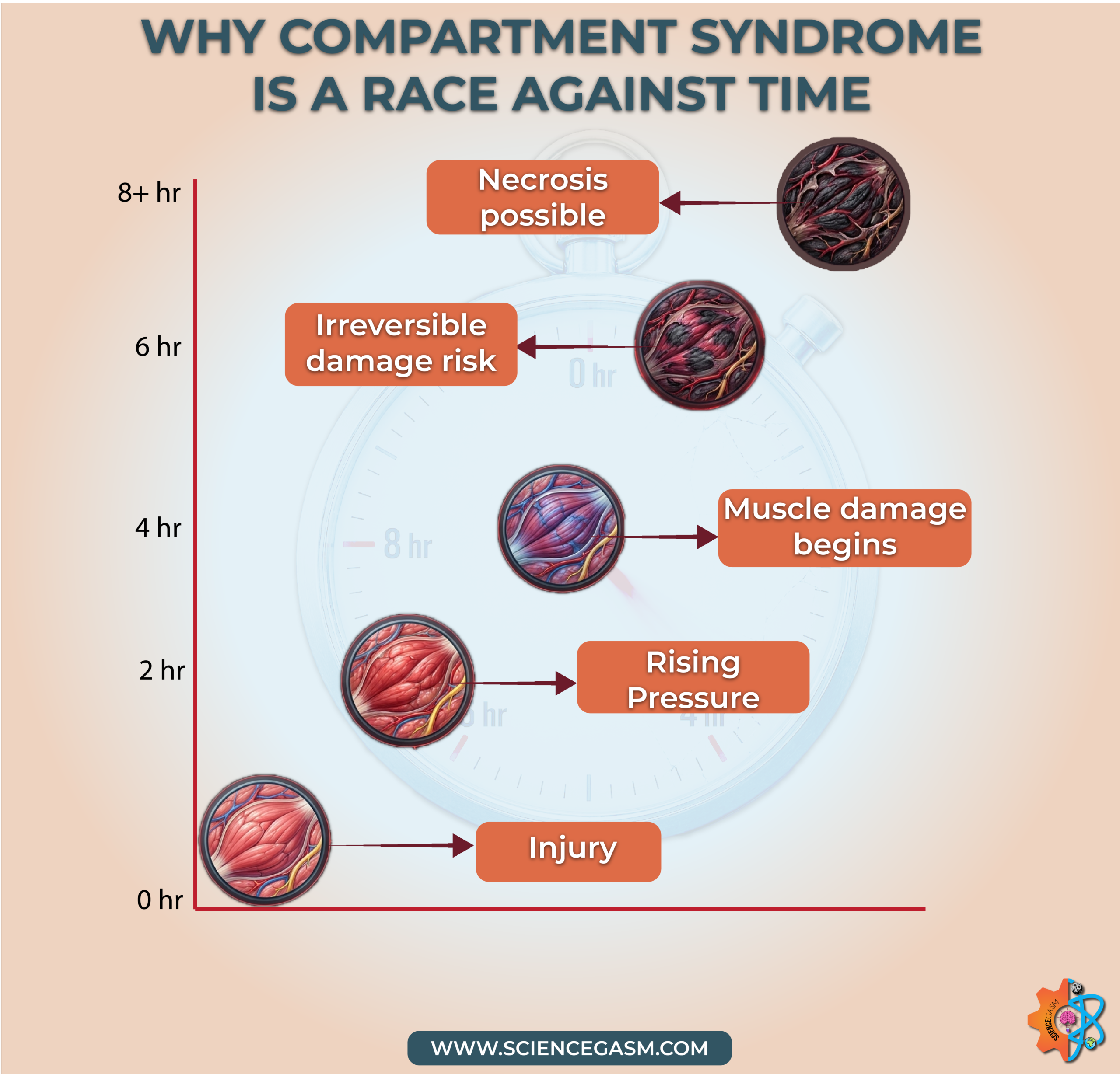 Compartment syndrome timeline showing muscle damage irreversible injury and necrosis over hours